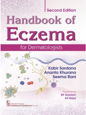 Handbook of Eczema  for Dermatologists