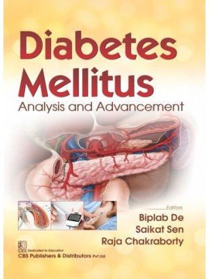 Diabetes Mellitus Analysis and Advancement 