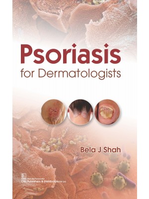 Psoriasis for Dermatologists