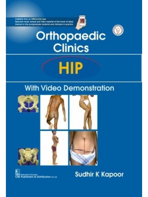 Orthopedic Clinics Hip With Video Demonstration