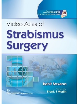 Video Atlas of Strabismus Surgery 